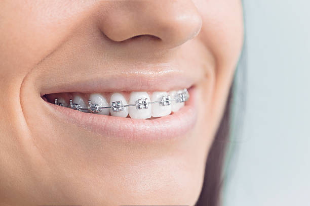Best Invisalign and Clear Aligners  in Bellemont, AZ